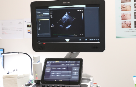 飞利浦EPIO 7C心血管超声诊断仪